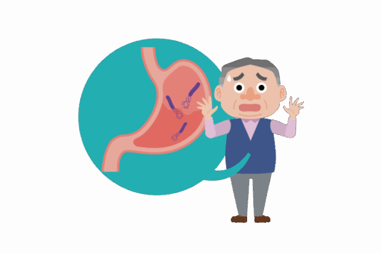 胃がん予防のために知っておきたいピロリ菌検査と除菌のすべて