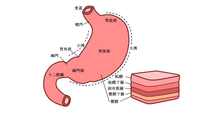 胃がん