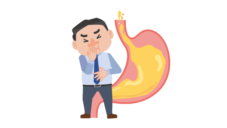 逆流性食道炎