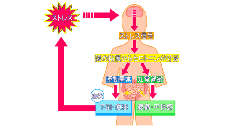 過敏性腸症候群セルフチェック