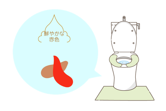 危険な便の色、見分け方。黒い・白い・赤い便は消化器のSOSかも - きなが内科・内視鏡クリニック