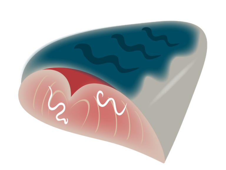 【神戸市・阪神間の方へ】その激痛、アニサキスかも？専門医が解説する食中毒の最新事情と胃カメラ治療
